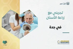 تجربتي مع زراعة الأسنان في جدة