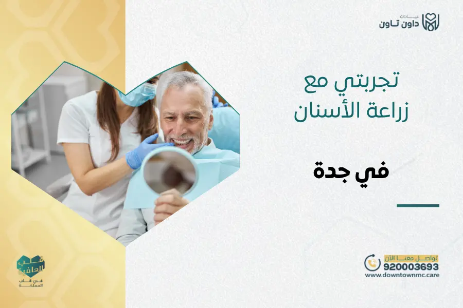 تجربتي مع زراعة الأسنان في جدة