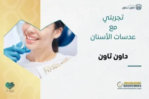 تجربتي مع عدسات الأسنان بدون نحت في داون تاون