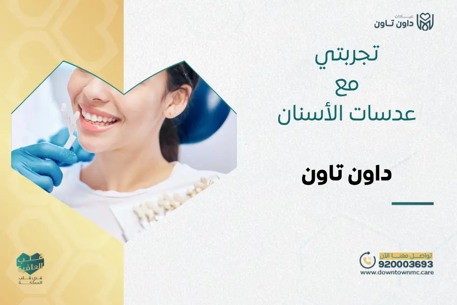 تجربتي مع عدسات الأسنان بدون نحت في داون تاون