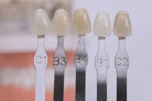 عملية تركيب الزركون