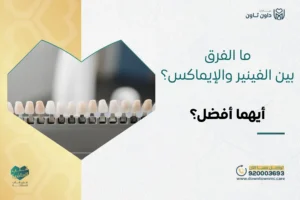 ما الفرق بين الفينير والإيماكس؟ وأيهما أفضل؟