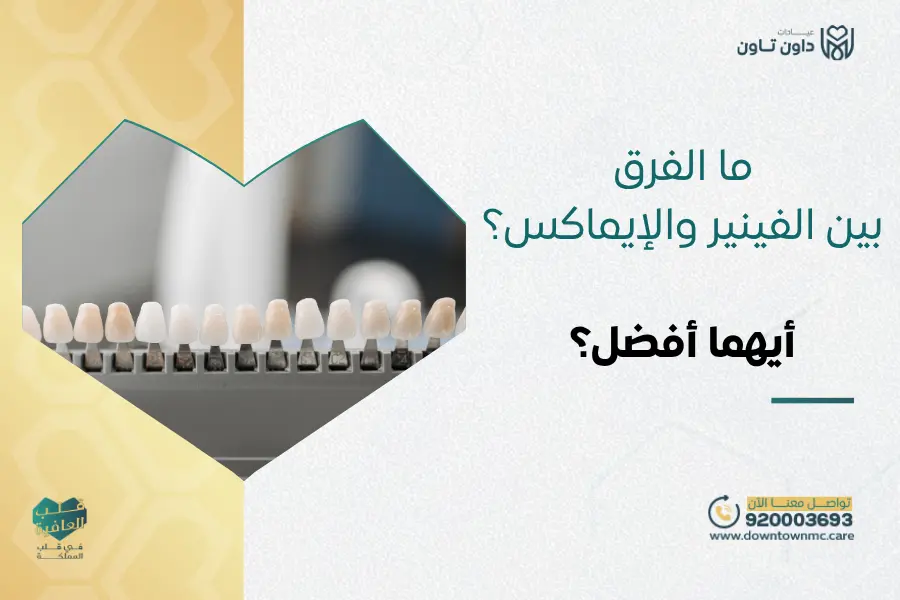 ما الفرق بين الفينير والإيماكس؟ وأيهما أفضل؟