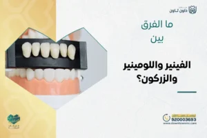 ما الفرق بين الفينير واللومينير للأسنان والزركون؟