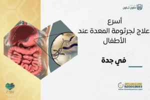 أسرع علاج لجرثومة المعدة عند الأطفال في جدة