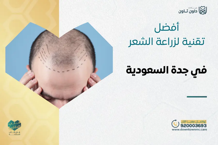 أفضل تقنية لزراعة الشعر في جدة السعودية