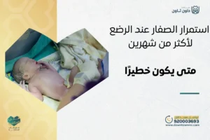 استمرار الصفار عند الرضع لأكثر من شهرين: متى يكون خطيرًا