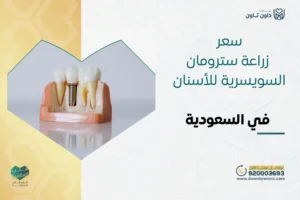 سعر زراعة سترومان السويسرية للأسنان في السعودية 2026