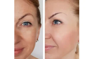 فوائد وأضرار إبرة انوفيال قبل وبعد