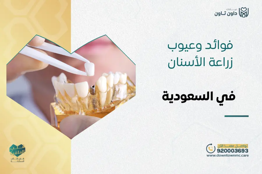 فوائد وعيوب زراعة الأسنان الفورية والتقليدية في السعودية