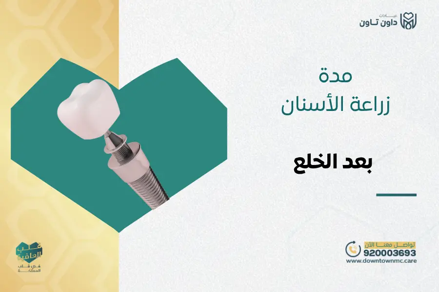 مدة زراعة الأسنان بعد الخلع