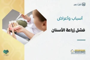 أبرز 5 أسباب وأعراض فشل زراعة الأسنان وكيفية تجنبها