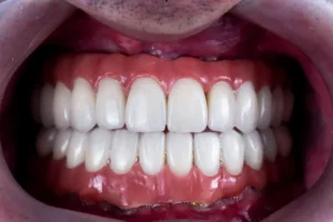 أفضل أطباء اللثة في الرياض
أفضل دكتور لعلاج اللثة في الرياض