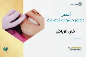 أفضل دكتور حشوات تجميلية في الرياض