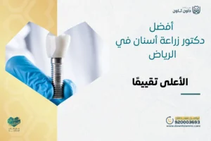 أفضل دكتور زراعة أسنان في الرياض الأعلى تقييمًا