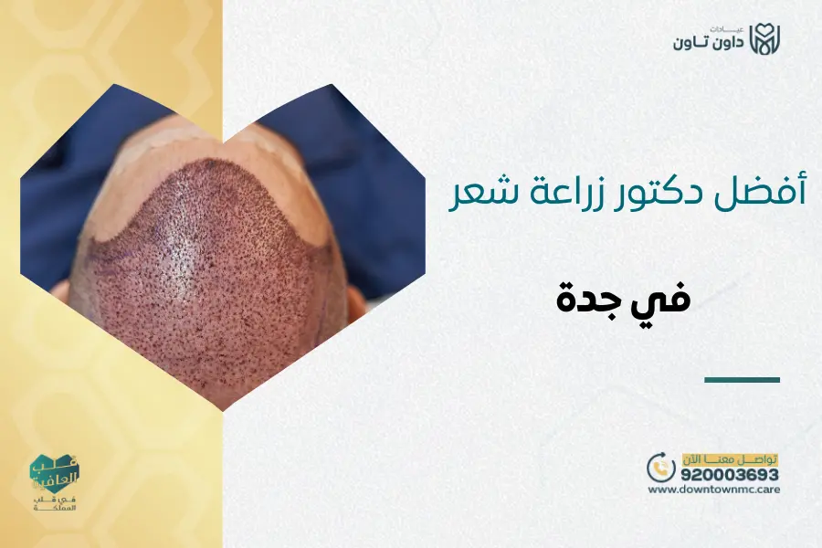 أفضل دكتور زراعة شعر في جدة