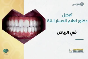 أفضل دكتور لعلاج انحسار اللثة في الرياض