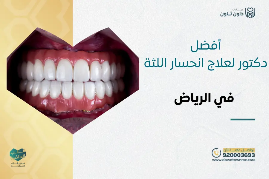 أفضل دكتور لعلاج انحسار اللثة في الرياض
