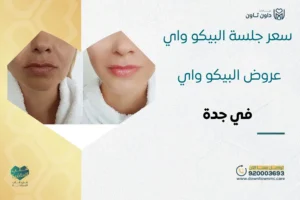 سعر جلسة البيكو واي | أفضل عروض جهاز البيكو واي في جدة