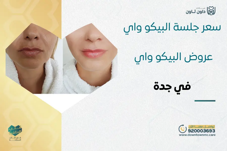 سعر جلسة البيكو واي | أفضل عروض جهاز البيكو واي في جدة