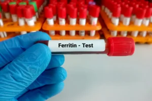 مخزون الحديد Ferritin المعدل الطبيعي للأطفال