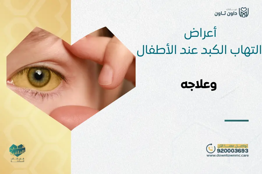 أعراض التهاب الكبد عند الأطفال وعلاجه