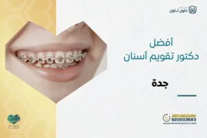 أفضل دكتور تقويم أسنان جدة