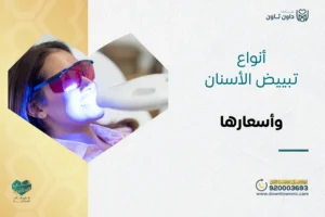 أنواع تبييض الأسنان وأسعارها