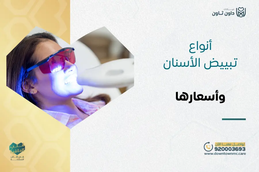 أنواع تبييض الأسنان وأسعارها