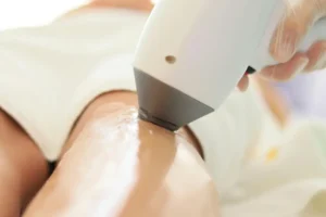 الفرق بين جهاز كانديلا جنتل برو وكانديلا جنتل ليزر أفضل جهاز ليزر في العيادات