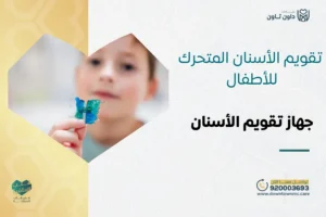 تقويم الأسنان المتحرك للأطفال: جهاز تقويم الأسنان للأطفال