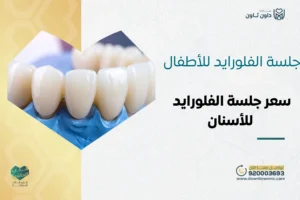 جلسة الفلورايد للأطفال: سعر جلسة الفلورايد للأسنان