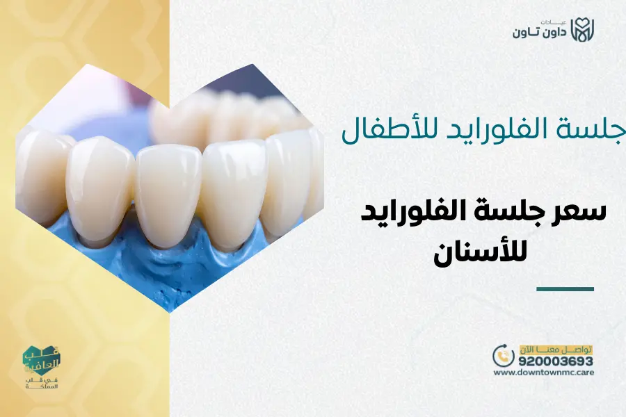 جلسة الفلورايد للأطفال: سعر جلسة الفلورايد للأسنان