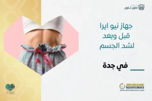 جهاز نيو ايرا قبل وبعد لشد الجسم في جدة