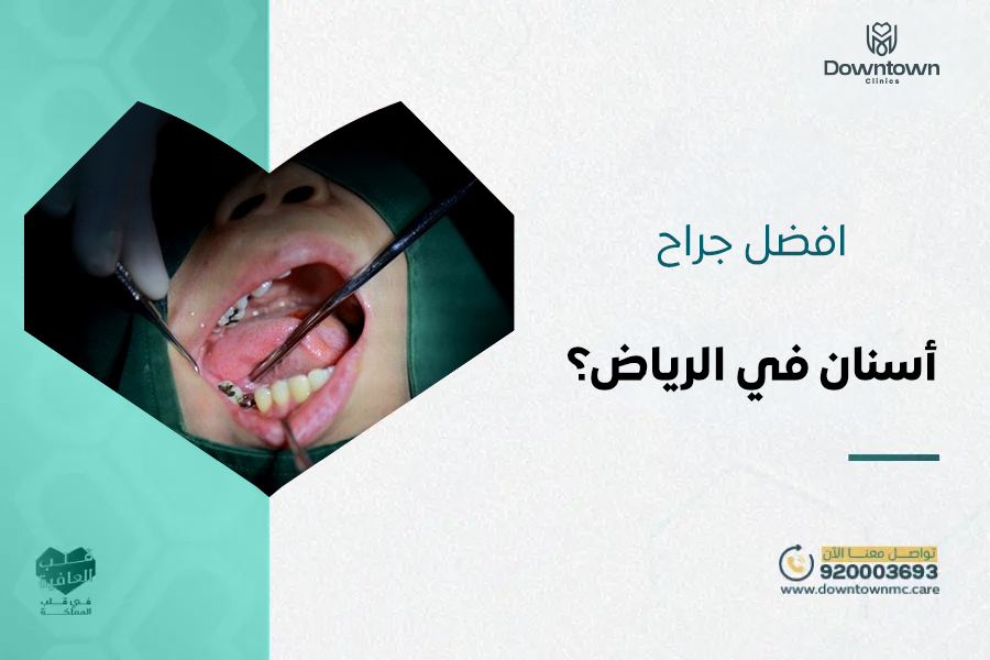 أفضل جراح أسنان في الرياض