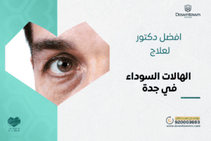 أفضل دكتور لعلاج الهالات السوداء في جدة
