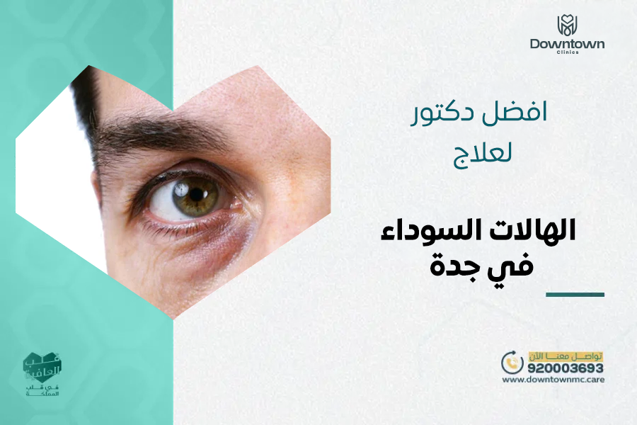 أفضل دكتور لعلاج الهالات السوداء في جدة