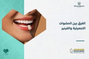 الفرق بين الحشوات التجميلية والفينير
