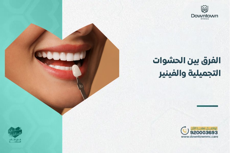 الفرق بين الحشوات التجميلية والفينير