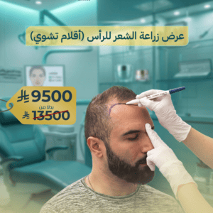 زراعة شعر الرأس بتقنية أقلام تشوي DHI