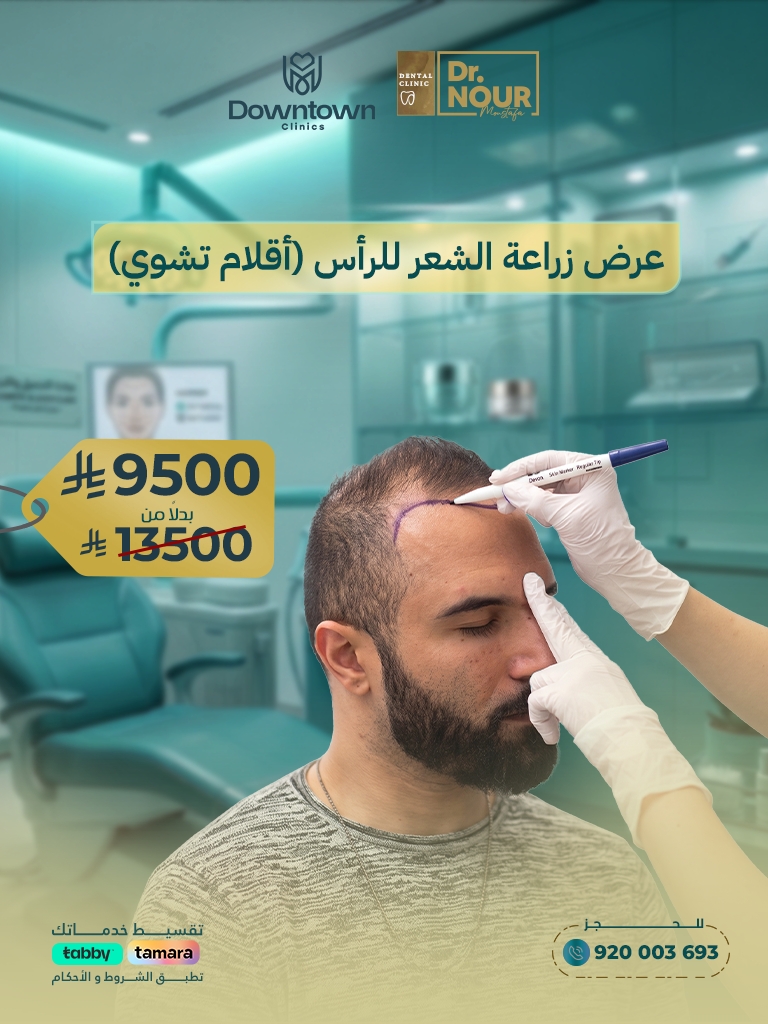 زراعة شعر الرأس بتقنية أقلام تشوي DHI