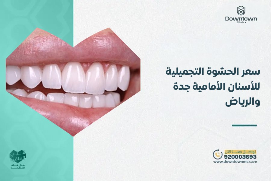 سعر الحشوة التجميلية للأسنان الأمامية جدة والرياض