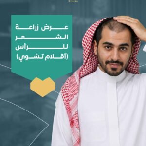 زراعة شعر الرأس بتقنية DHI