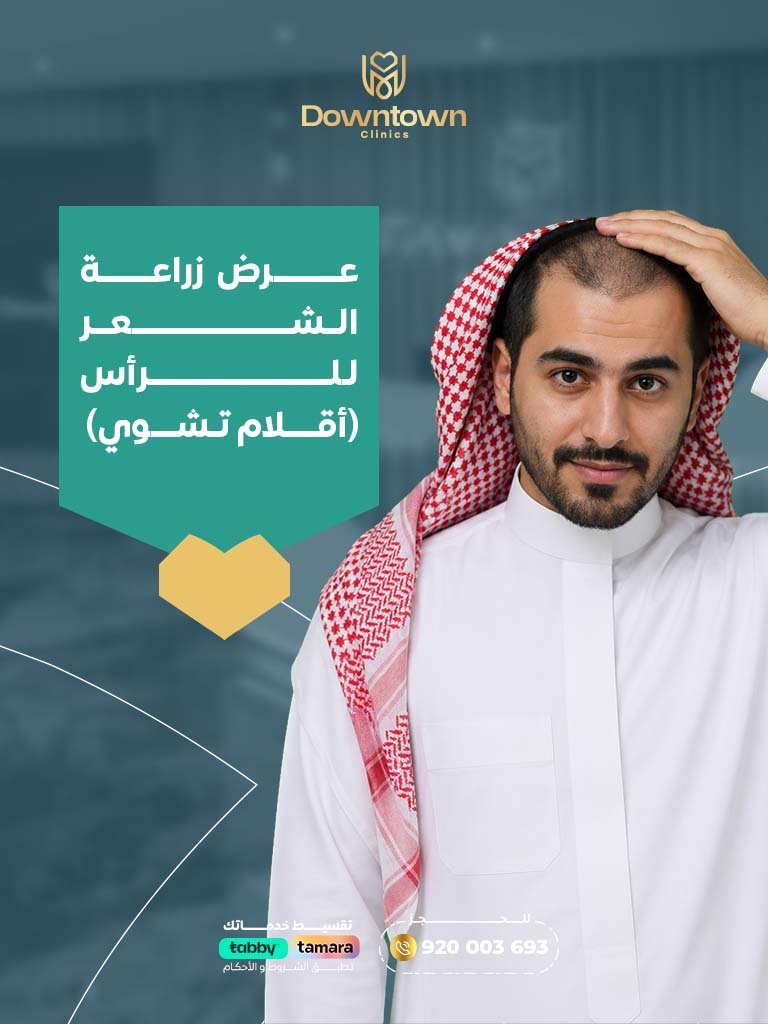 عرض زراعة الشعر للرأس (أقلام تشوي)