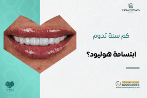 كم سنة تدوم ابتسامة هوليود