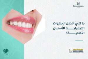 أفضل الحشوات التجميلية للأسنان الأمامية