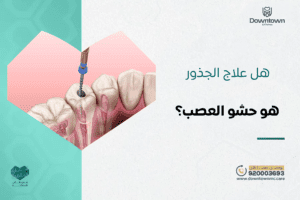 هل علاج الجذور هو حشو العصب