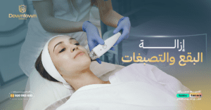 إزالة البقع والتصبغات بالليزر في السعودية
