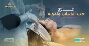 علاج حب الشباب وندوبه بالليزر في السعودية