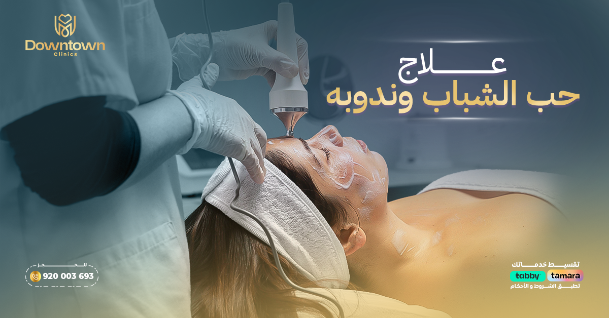 علاج حب الشباب وندوبه بالليزر في السعودية
